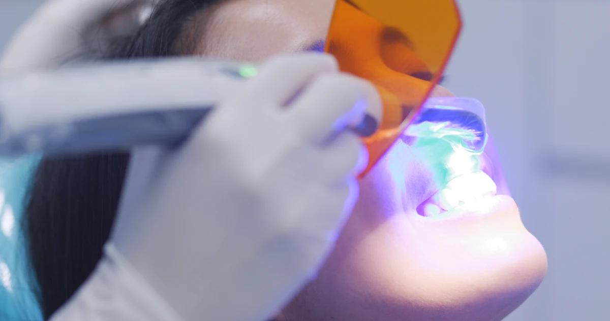 Teeth whitening with an activation light at the Rita Goutkin practice in Cologne
